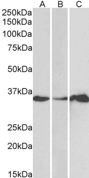 LASP1 Antibody