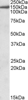 KL Antibody