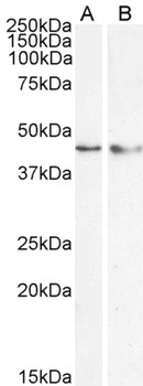 KLF15 Antibody