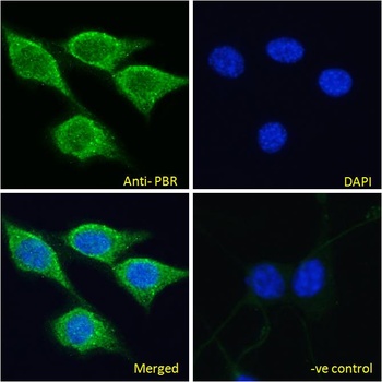 Tspo Antibody