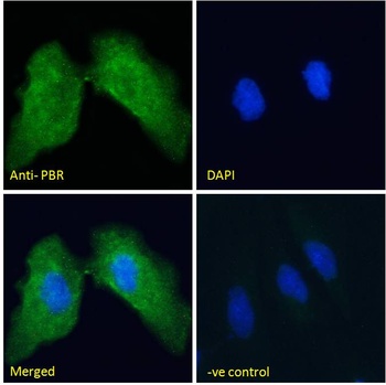 Tspo Antibody