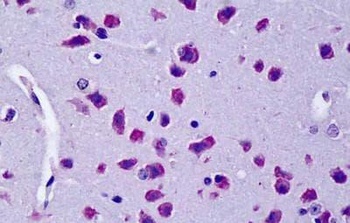 KCNC3 Antibody