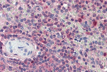 KPNB1 Antibody
