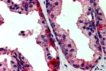 JIK Antibody