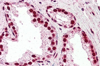 IRF6 Antibody