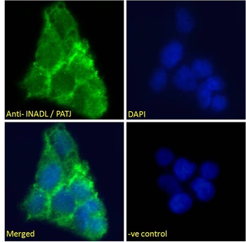 INADL Antibody