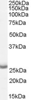 IL12B Antibody