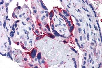 IL12B Antibody