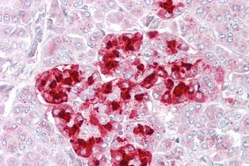 IGFBP6 Antibody