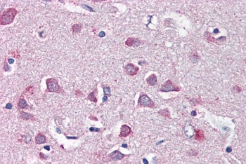 HTATSF1 Antibody