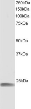 HSPB8 Antibody