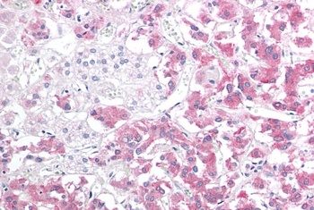 HSPB8 Antibody
