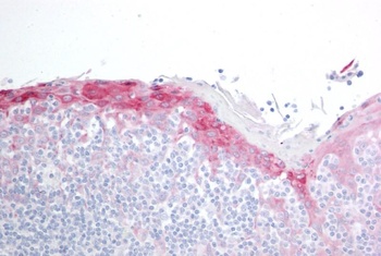 HSPB8 Antibody
