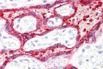 HSD3B1 Antibody