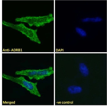 HSD3B1 Antibody
