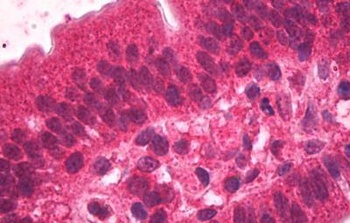 HNF4A Antibody