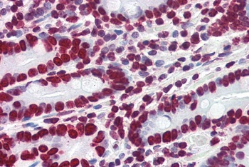HMGA1 Antibody