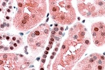HRH1 Antibody