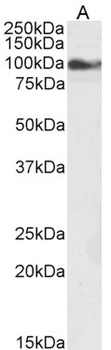 Histamine Receptor H1 Antibody