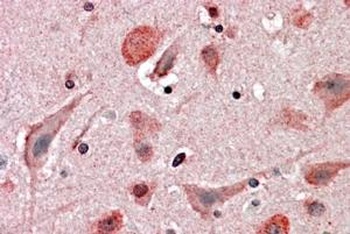 HIP2 Antibody