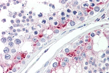 ZDHHC17 Antibody