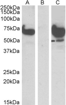 ZDHHC17 Antibody