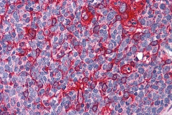 GTRAP3-18 Antibody