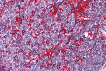 ARL6IP5 Antibody