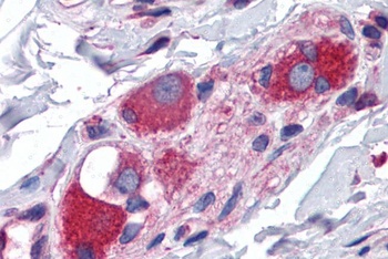 GTRAP3-18 Antibody