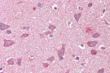 GRASP1 Antibody