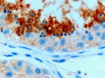 GPX4 Antibody