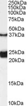 GPSM2 Antibody