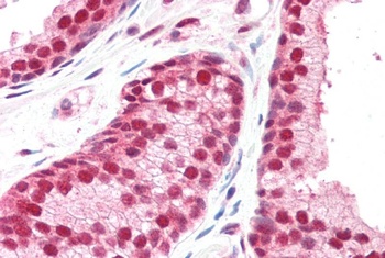 GPS1 Antibody