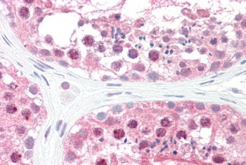 GPS1 Antibody