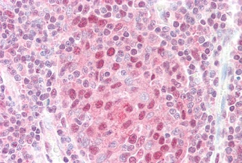 GPS1 Antibody