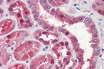 GOT1 Antibody
