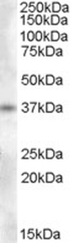 GOT1 Antibody