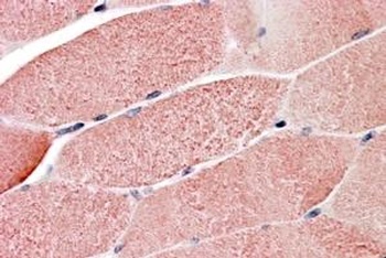 GNIP Antibody