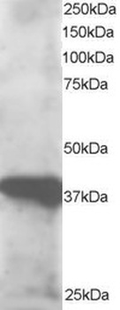 GIPC3 Antibody