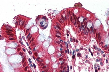Ghrelin Preproprotein Antibody