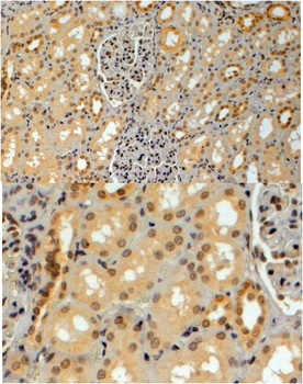 TRIM8 Antibody