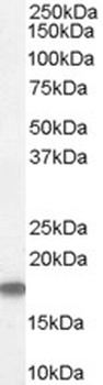 GEF5 Antibody