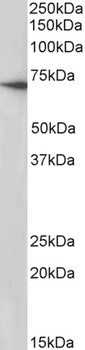 ENT1 Antibody