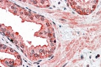 CCNDBP1 Antibody