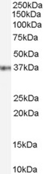 GATA5 Antibody