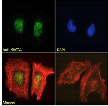 GATA1 Antibody