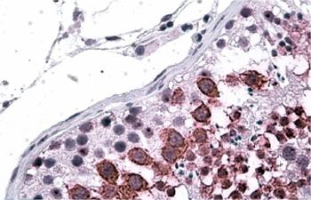 GALR3 Antibody