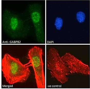 GABPB2 Antibody