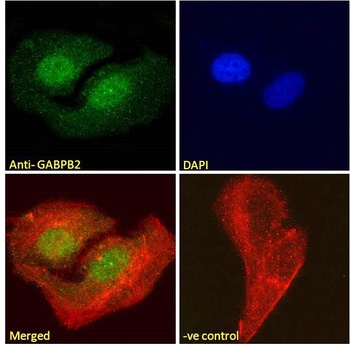 GABPB2 Antibody