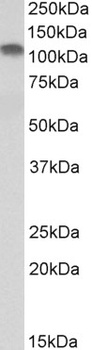 GABPB2 Antibody